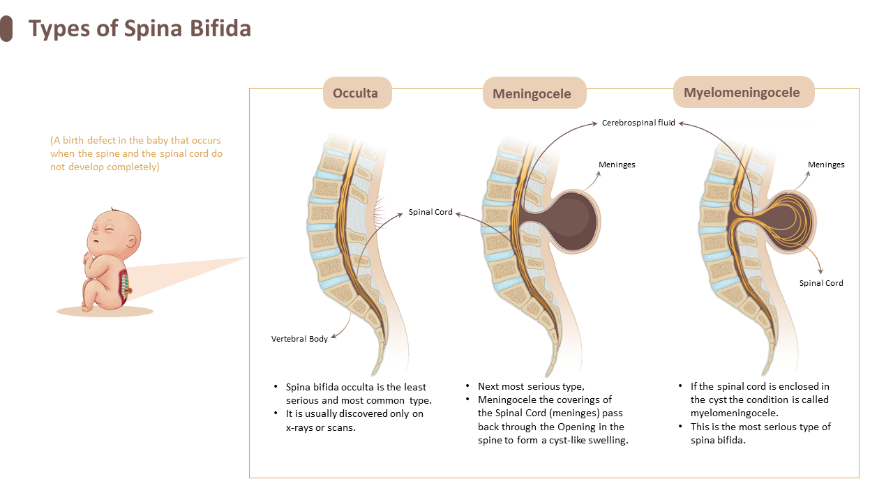 Medical Slide 5